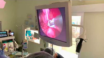 停留睾丸の去勢手術（腹腔鏡）|りんごの樹動物病院